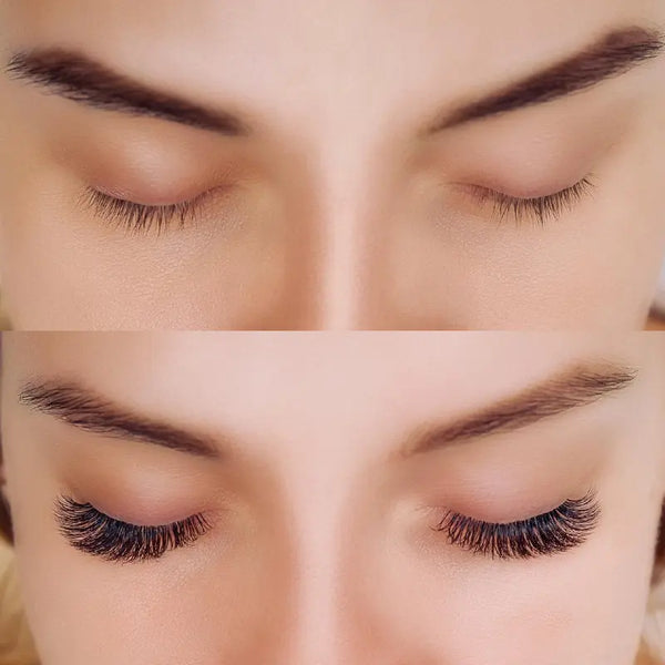 Beneficios principales